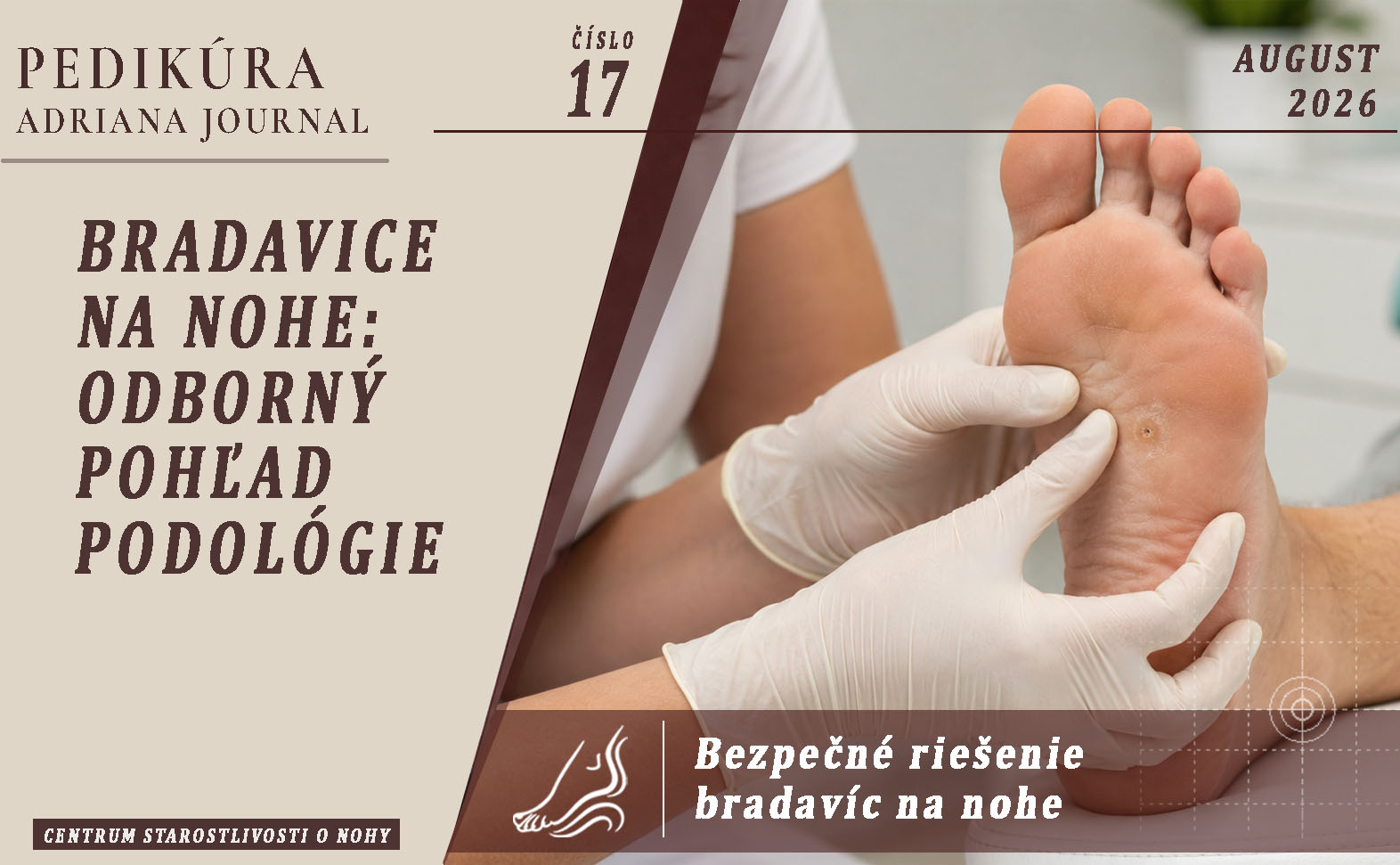 Bradavice na nohe: odborný pohľad podológie