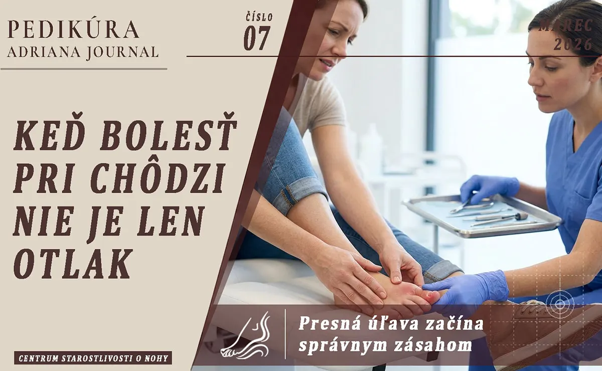 Keď bolesť pri chôdzi nie je „len otlak“